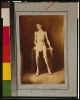 A Federal prisoner, returned from prison, standing, full-length, nude, facing front