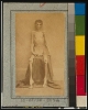 A Federal prisoner, returned from prison, full-length, seated, nude, facing front